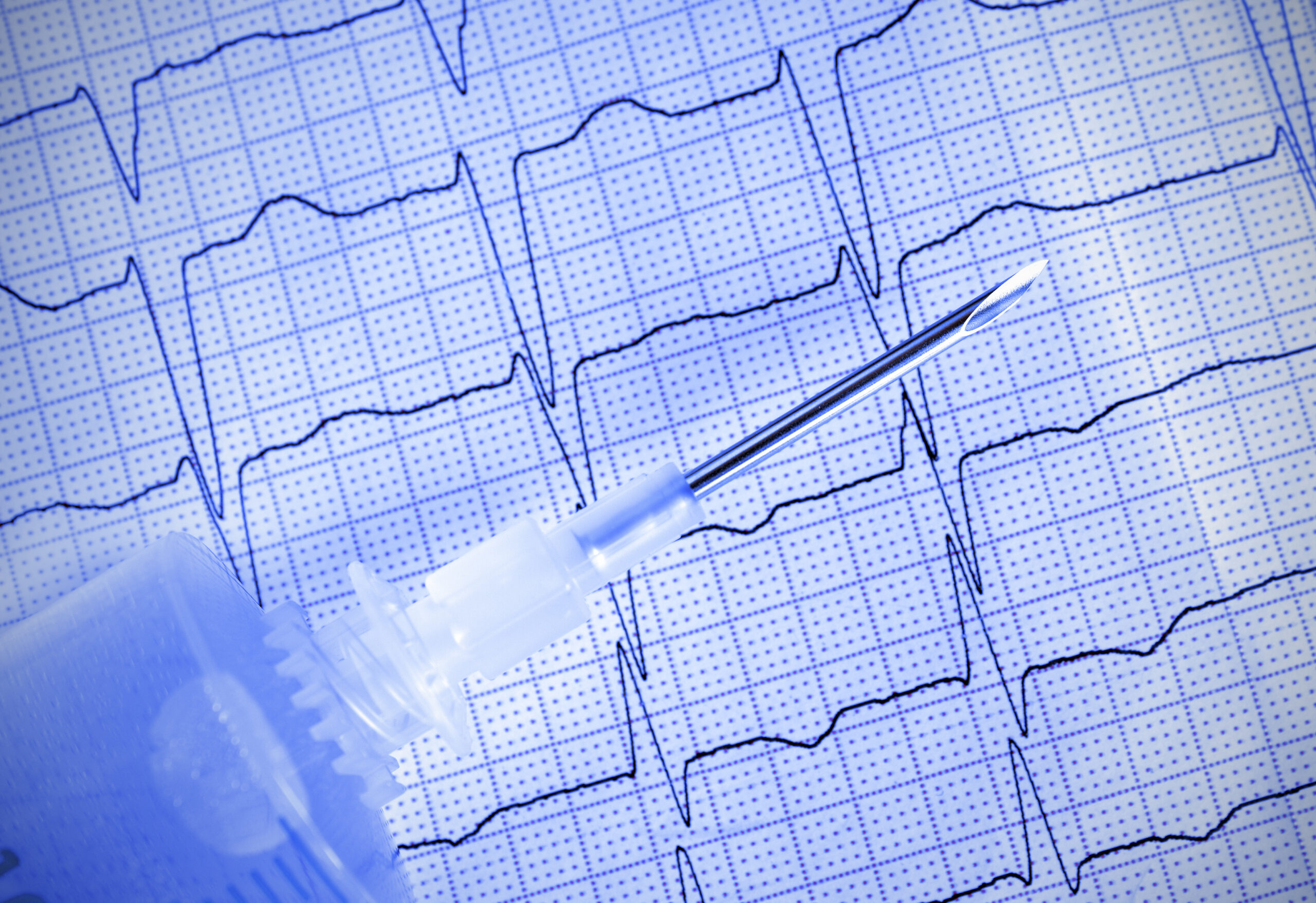 Close-up of an EKG heart rhythm printout with a syringe needle laid across it.